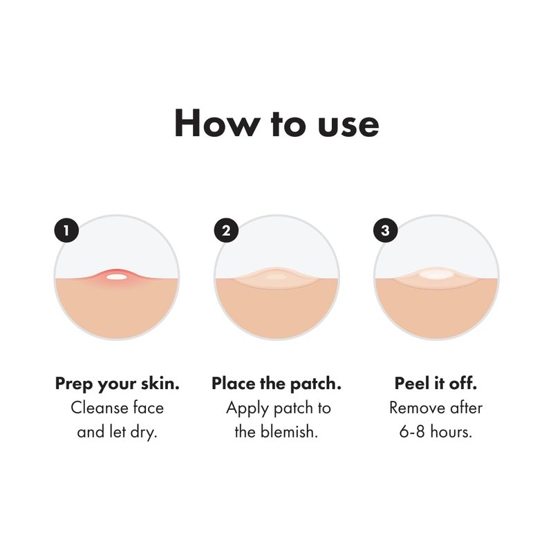 Mighty Patch™ Invisible+ Acne Pimple Patch - Hydrocolloid Cover for Zits & Blemishes | 72 Count