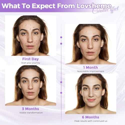 Red Light Therapy for Face, LED Face Mask Light Therapy, Red Light Therapy Mask for Acne, Wrinkles and Skin Rejuvenation, 320 LEDS, 3 Modes, 10-Min Auto Off, Eye Protection Included