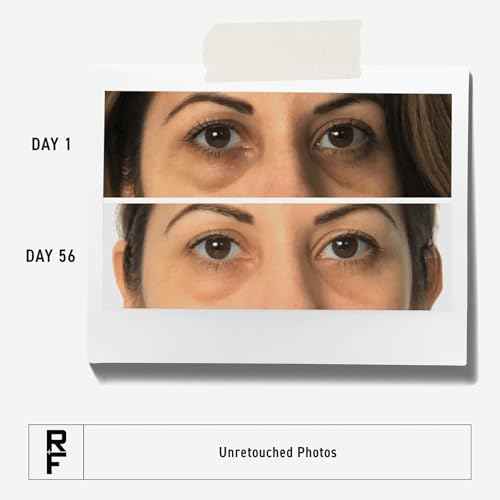 RODAN + FIELDS Active Hydration Bright Eye Complex | 15ml | Moisturizing Under Eye Cream for Dry Skin | Eye Treatment for Refreshed Appearance | Skincare