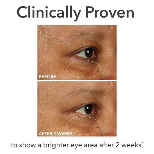 Dr Dennis Gross DermInfusions Fill + Repair Eye Cream: Hydrating & Brightening Treatment for Dark Circles, Fine Lines & Wrinkles, Firms & Smooths 360¡Æ Eye Area, 0.5 Oz