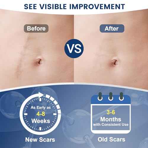 100% Silicone Scar Gel Scar Cream, Advanced Silicone Gel for Removal of Surgical, Burns, Acne Scar, Old and Recent Scars and Stretch Marks, 1.7 oz/50ml