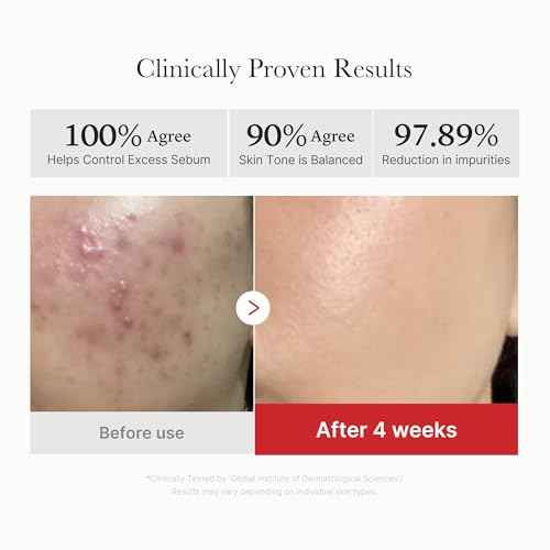 Medicube Red Succinic Acid Panthenol Facial Peeling Pads - Exfoliating Toner Pads for Breakout-Prone Skin with Niacinamide, AHA, BHA, and Soothing Panthenol - Non-Comedogenic