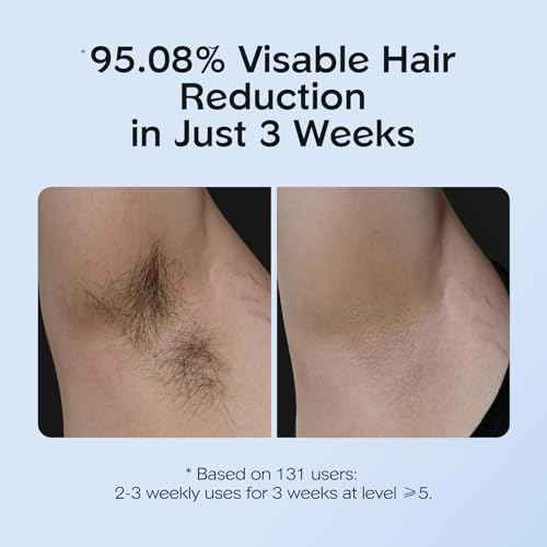 INNZA IPL Hair Removal with Ice Cooling Care Function for Women,Long-Lasting Results,999,999 Flashes Painless Hair Removal, Hair Removal Device for Armpits Legs Arms Bikini Line