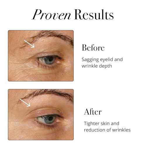Glotrition Super Beauty Elixir - Collagen Peptides Powder for Skin, Hair & Nail Health. Natural Grass Fed Collagen with Biotin, Hyaluronic Acid & Antioxidants (30ct)