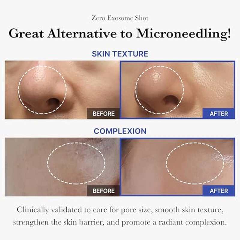 Medicube Flawless Skin Vitamin C Golden Capsule Face Moisturizer - 7,500 PPM Exosome Serum