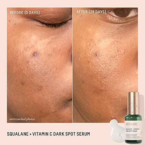 Biossance Squalane + Vitamin C Dark Spot Face Serum ? 10% Vitamin C Serum & White Shiitake ? Hydrating, Fragrance-Free, Non-Irritating, for Daily Use for All Skin Types