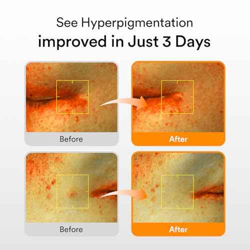 Abib Glutathiosome Dark Spot Serum Vita drop 1.69 fl.oz. | Korean Skincare, Dark Spot, Hyperpigmentation Treatment | Serum for Sensitive, Uneven Skin