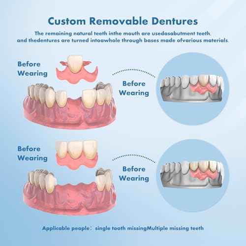 Custom Removable Dentures ? Personalized Partial Denture Set for Tooth Replacement | 1?Multi-Tooth Coverage with Storage Case | Comfortable Wear for teeth (1 Tooth)