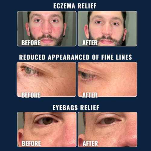 Prettyboy Face Revival Gel Moisturizer For Men - Hydrating Cream That Refreshes Dry Skin, Irritation, & Redness - Supports Anti Aging & Anti Wrinkle - Fragrance Free - 2 Count