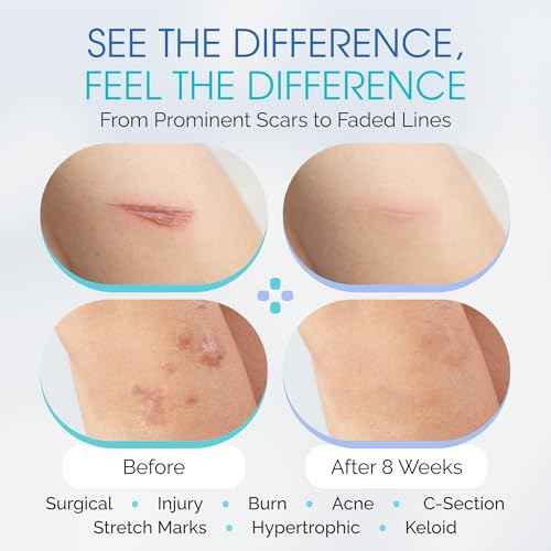 100% Silicone Scar Gel Cream Serum ? Silicone + Massage Power Duo Scar Therapy w/Tri-Roller Tip for Surgical, C-Section, Acne, Burn & Keloid Bump Scars ? Hypoallergenic & Fragrance Free