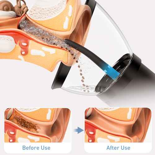 Ear Wax Removal-Electric Ear Cleaner, Retractable Ear Cleaning Kit, Safe Ear Wax Removal Tool, Effective Ear Irrigation Flushing System, Waterproof Ear Washer for Humans with 4 Pressure Modes
