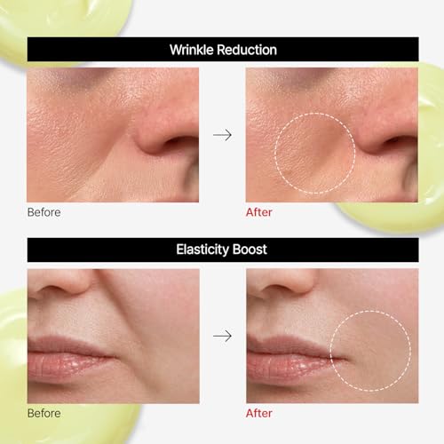 Dr.Different VITALIFT-A Forte Retinal 0.1%, Intensive Anti-Aging Cream for Wrinkle Reduction, Skin Elasticity, Lifting, Firming with Vita A, K-Skincare made by Korean Dermatologist. 0.7oz