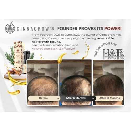 Hair Growth Oil with Rosemary & Cinnamon ? Thicker Hair, Scalp Nourishment & Strength ? Lightweight, Non-Greasy, Fast Absorbing Formula ? 60 ml (2 fl oz) Bottle with Pump Dispenser