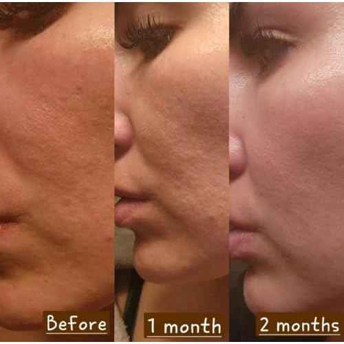 Rejuvenating Facial Night Cream with Retinol, Tepezcohuite, Niacinamide - cruelty-free, vegan, paraben-free silicone-free Mexican Natural skincare ingredients