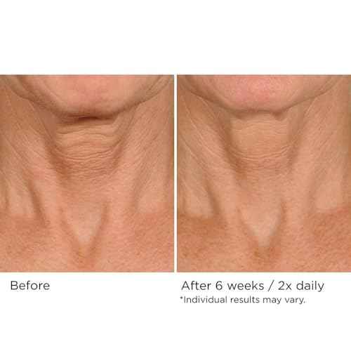 NassifMD Deco-Lift Neck Firming Complex Serum