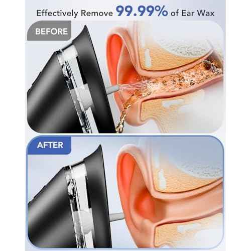 Ear Wax Removal - Electric Ear Cleaner with LED Display, Ear Cleaning Kit Effective & Safe Ear Wax Cleaner Irrigation Flushing System, 3 Pressure Modes, 12 Tips