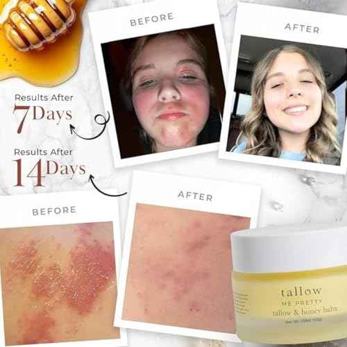 Tallow and Honey Balm, Rich and Comforting Grass Fed Beef Tallow Balm, Seals in Moisture, Promotes Skin Repair & Calms Irritated Skin, 1.7 oz