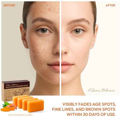 Kojic Acid Soap, Turmeric Soap Bar for Dark Spots Brightening & Moisturizing with Collagen, Vitamin E, Retinol, Hyaluronic Acid, Shea Butter, Paraben & Sulfate-Free 105g x4 Bars