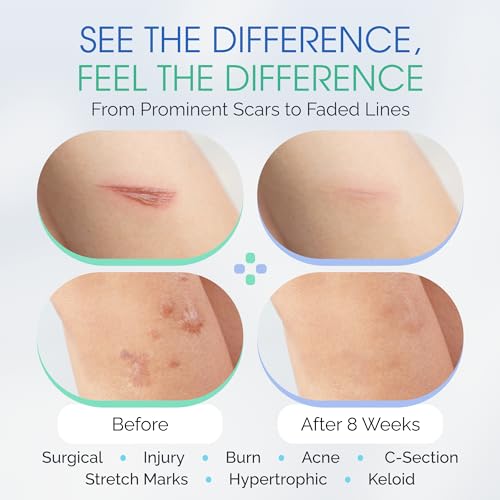 100% Silicone Scar Gel Cream Serum ? Ultra-Soft Brush Applicator for Gentle Scar Therapy After Cosmetic Procedures, Facial Peels, Surgical, Acne, Burn & Keloid Scars ? Hypoallergenic & Fragrance Free