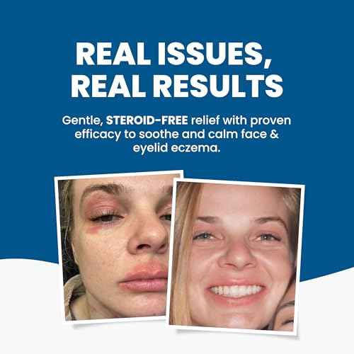 Grahams Natural Face & Eyelid Oil - For Very Dry Skin Around Eye & Face, Eczema & Perioral Dermatitis - Steroid-Free, Hypoallergenic, Non-Comedogenic - 100% Pure - with Argan & Jojoba Oil (1.69 Fl Oz)