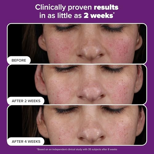 Paula¡¯s Choice Pro Retinaldehyde Dual-Retinoid Face Serum Advanced Treatment, High Potency Anti-Aging Serum for Face, Breakout-Prone Skin, Radiance & Rough, Bumpy Texture, Fragrance-Free