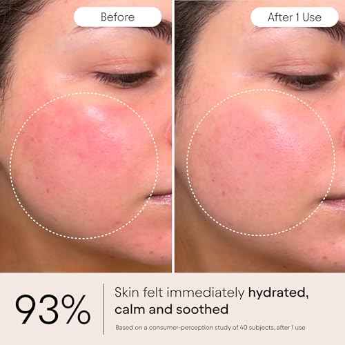 Alpyn Super Peptide & Ghostberry Moisturizer for Eczema, Barrier & Wrinkle Repair | Calm & Soothe Against Redness & Irritation | 1.7 oz / 50 ml