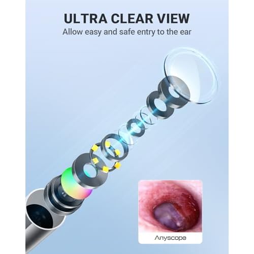 Wireless Otoscope with Gyroscope, Ear Camera with Dual View, 3.9 mm Otoscope with Light, Ear Scope with Ear Wax Removal Tool for Kids, Adults, and Pets, Compatible with iPhone and Android