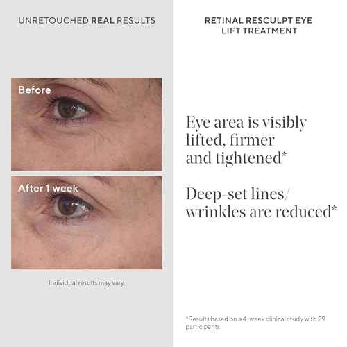 Murad Retinal ReSculpt Eye Lift Treatment - Age-Defying Eye Cream with Encapsulated Retinal, Gentian Root, & Oat-Firming Film for Youthful Eyes - Tightens Droopy Lids & Under-Eye Bags - 0.5 Fl Oz