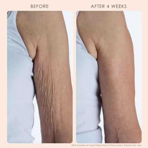 Crepe Erase Body Smoothing Pre-Treatment with Trufirm Complex
