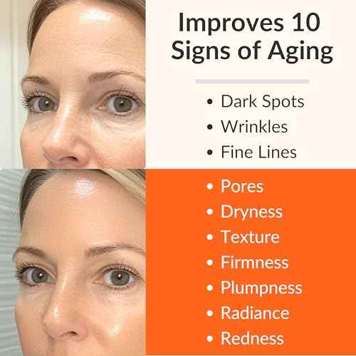 LeVaye Vitamin C Serum, Anti-Aging Face Serum ? 15% Vitamin C, Ferulic Acid, Niacinamide, Hyaluronic Acid, Peptides, Ceramides ? Targets Wrinkles, Fine Lines, Dark Spots, Enlarged Pores, Dry Skin