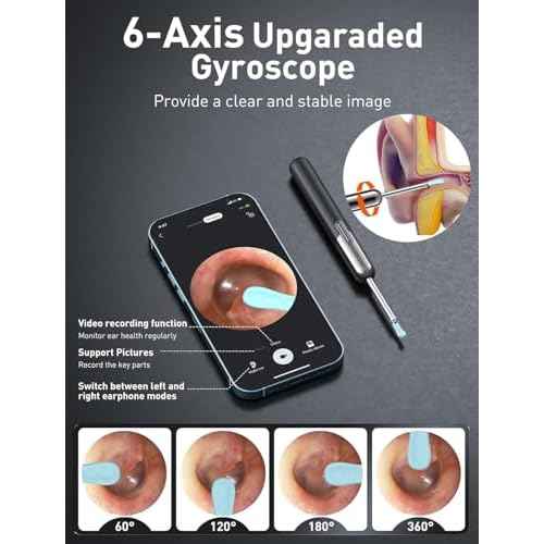 Ear Wax Removal, Ear Cleaner with Camera and Light, Ear Wax Removal Kit, Ear Wax Removal Tool Camera with 1080P, Ear Cleaning Kit with Spoons, Ear Camera for iOS & Android