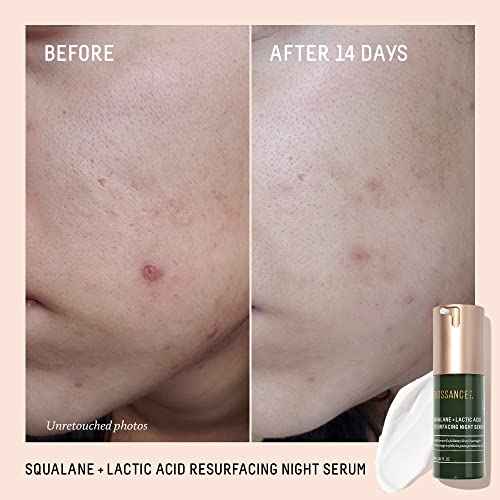 BIOSSANCE Squalane + Lactic Acid Resurfacing Night Serum - Vegan 10% Lactic Acid Face Serum for Skin Texture and Fine Lines - Gentle Night Exfoliant, Hydrating - Pore Reducer for Face, 1.0 Ounce