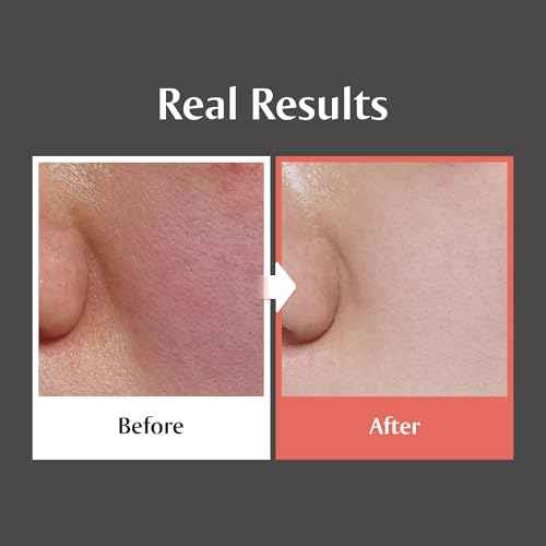 [Redence] 5% Niacinamide & Triple Hyaluronic Acid Skin Barrier Moisturizer Cream for Even Tone, Deep Hydration & Sensitive Skin Care, 1.69 fl oz