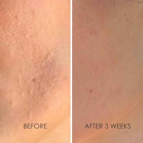 REFLEKT 2 Collagen Boost Vitamin C Serum