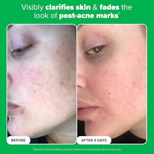 Paula's Choice BOOST 10% Azelaic Acid Booster Cream Gel Face Serum with Salicylic Acid, Oil-Free Skin Brightening Serum for Face, Fragrance-Free