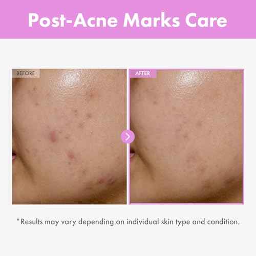 TOSOWOONG 9 Peptide Skin Booster Serum, Niacinamide & Hyaluronic Acid Skin Renewal Boosting Facial Essence for All Skin Types, Korean Skin Care, Paraben Free, 150ml, 5.07 fl.oz.