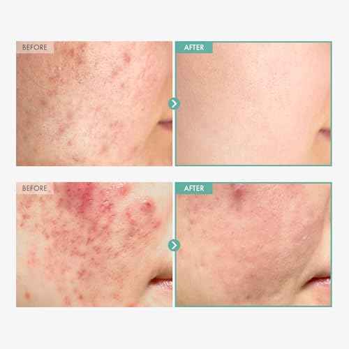 TOSOWOONG Dexpanthenol Cream, 170,000ppm B5 Panthenol, Madecassoside, Centella Asiatica for Skin Barrier Repair, Facial Moisturizer, Soothing, Hydrating, Korean Skincare, 60ml, 2.02 fl. oz.