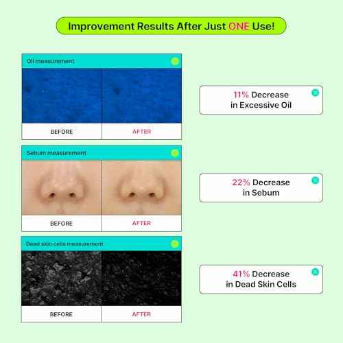 Calming Tok Cica Heartleaf Trouble Pads, Cooling & Hydrating Facial Toner Pads for Sensitive Skin, Mild Exfoliating & Soothing, Easy-Split for Multi-Use, Daily Korean Skin Care (70 Sheets)