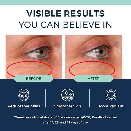 Anti-Aging Retinol Collagen Serum for Face- 1% Encapsulated Retinol, Niacinamide & Hyaluronic Acid Improves Wrinkles, Hydration, Skin Texture. Gentle for Sensitive Skin-Fragrance Free-1 FL OZ
