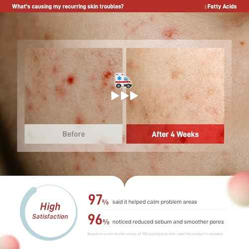 Zeroca 81 Korean Calming Cream for Acne-Prone & Sensitive Skin ? Lightweight and gentle daily soothing moisturizer, Controls Sebum, Deeply Hydrates & Smooths Texture (2.02 fl.oz. 60 ml)