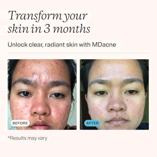 MDacne 3 Step Benzoyl Peroxide Acne Kit - Benzoyl Peroxide Cream 2.5%, Salicylic Acid Cleanser, Niacinamide Moisturizer - Medicated Plant-Based kit for Adult & Teen Acne, 60 Day Kit + Pimple Patches