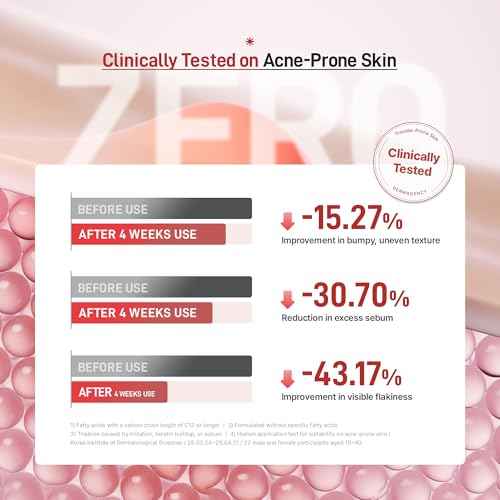 Zeroca 81 Korean Calming Cream for Acne-Prone & Sensitive Skin ? Lightweight and gentle daily soothing moisturizer, Controls Sebum, Deeply Hydrates & Smooths Texture (2.02 fl.oz. 60 ml)
