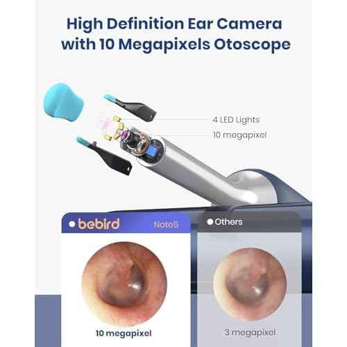 Bebird Note 5 Ear Camera Wax Removal, Ear Wax Removal Tool Camera Ear Tweezers with Camera, 10 Megapixels Ear Otoscope Camera, 12 Ear Spoon, Ear Cleaner with Camera for Earwax Cleaning