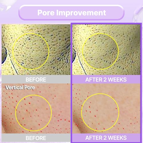 BIOHEAL BOH Probioderm¢â Collagen Remodeling Cream 1.69 fl oz (50 ml) | Pore Tightening Cream with 150,000 Collagen Capsules for Firmness & Smooth Texture | Lightweight Moisturizer for Flawless Skin