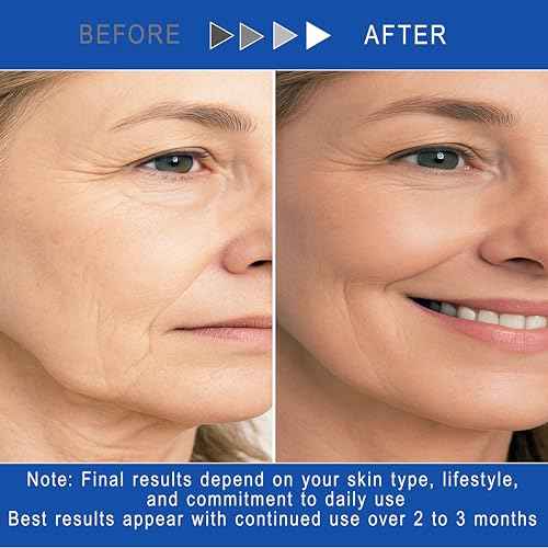 ELEONORE Instant Face Lift Cream, Face Moisturizer, Lotion for Extremely Dry Skin - Face Moisturizer For Aging Skin, Mens face lotion, Clinically Tested. 1.7 Oz