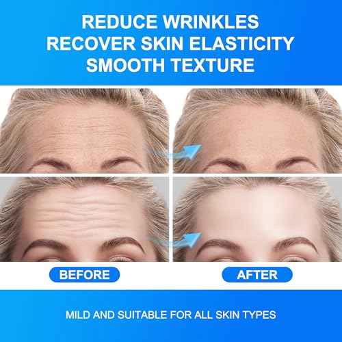 Forehead Wrinkle Patches Overnight 14pcs with Collagen, jelly forehead patches help smoother Wrinkle Filler & Deep Line, Gentle Skin Care Gifts Set for Women