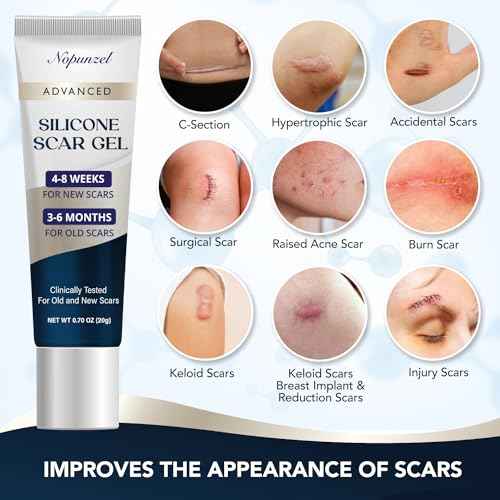 Silicone Scar Gel: Silicone Gel for Scars - Improve Scar Appearance for Old and New Scars - Medical Grade Silicone - Advanced Scar Gel - Scalds - Surgery - Injury - Stitches - Burns - 20g