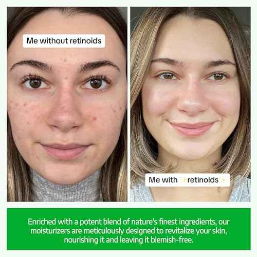 USDA Organic Retinol Face Cream 2.5% - Beginner-Friendly Anti Aging Moisturizer for Sensitive Skin with Liposomal, Hyaluronic Acid & Collagen Booster - Fragrance Free, Made in USA, 2 oz