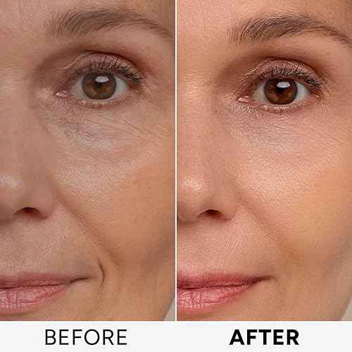 Retinol Cream for Face with Collagen, Peptides - Anti Aging Wrinkle Cream for Women and Men - Day-Night Facial Moisturizer with Hyaluronic Acid - Tightening and Skin Firming - Neck & D?collet?