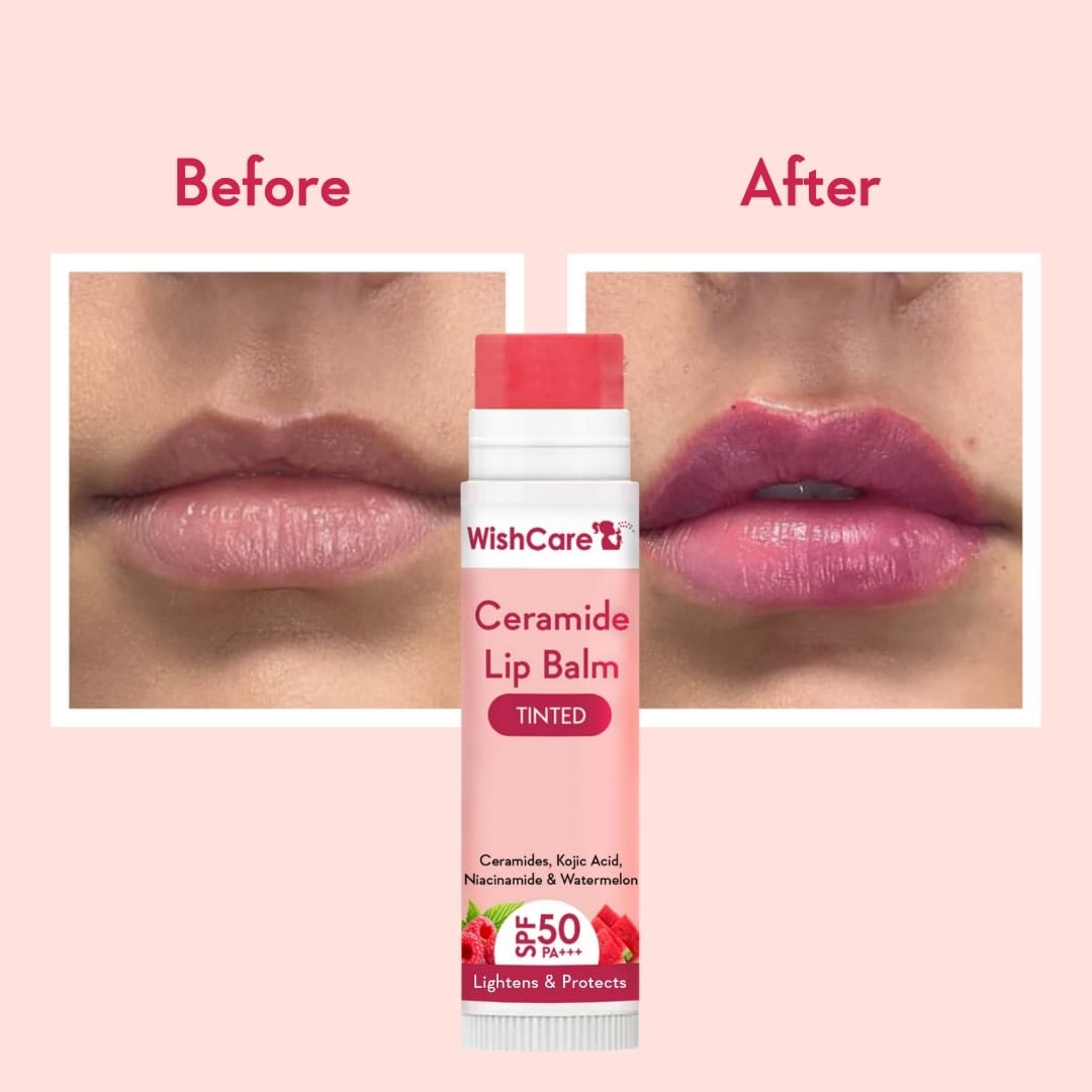 WishCare Tinted Lip Balm with SPF 50 PA+++ – Enriched with Niacinamide, For Women, 5g